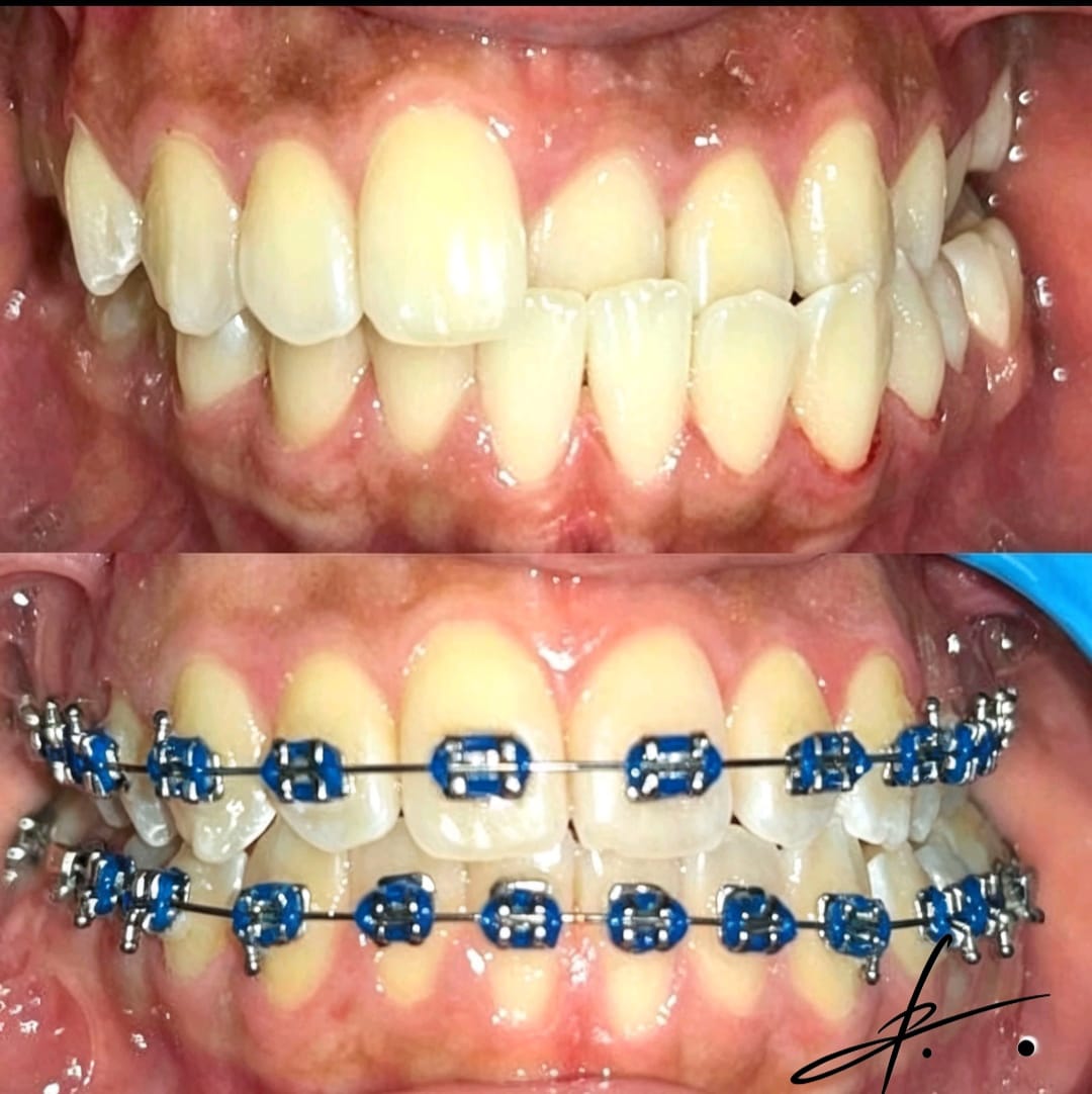 sonrisa alienada
