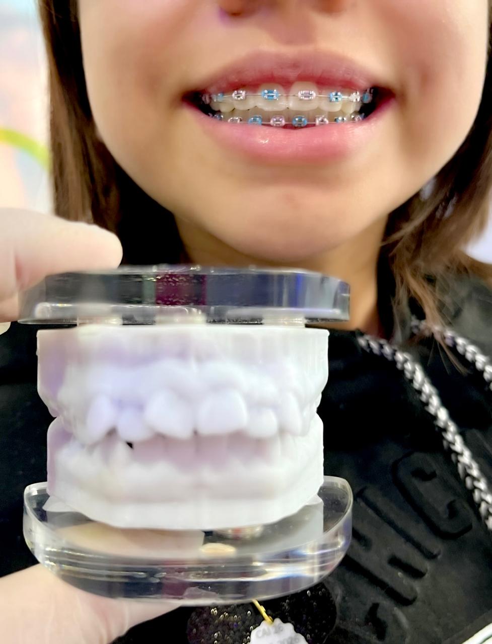 sonrisa con brackets